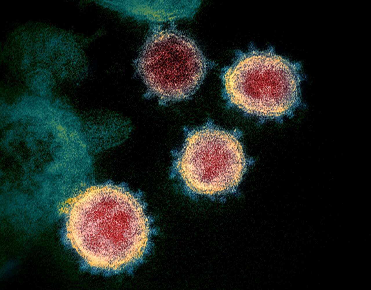 1280px Novel Coronavirus SARS Co V 2