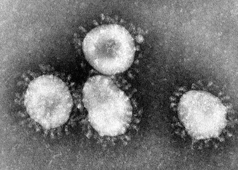 800px Coronaviruses 004 lores