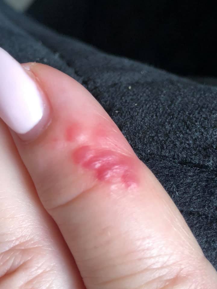 Pluskwy na meblach z Salonu Agaty4