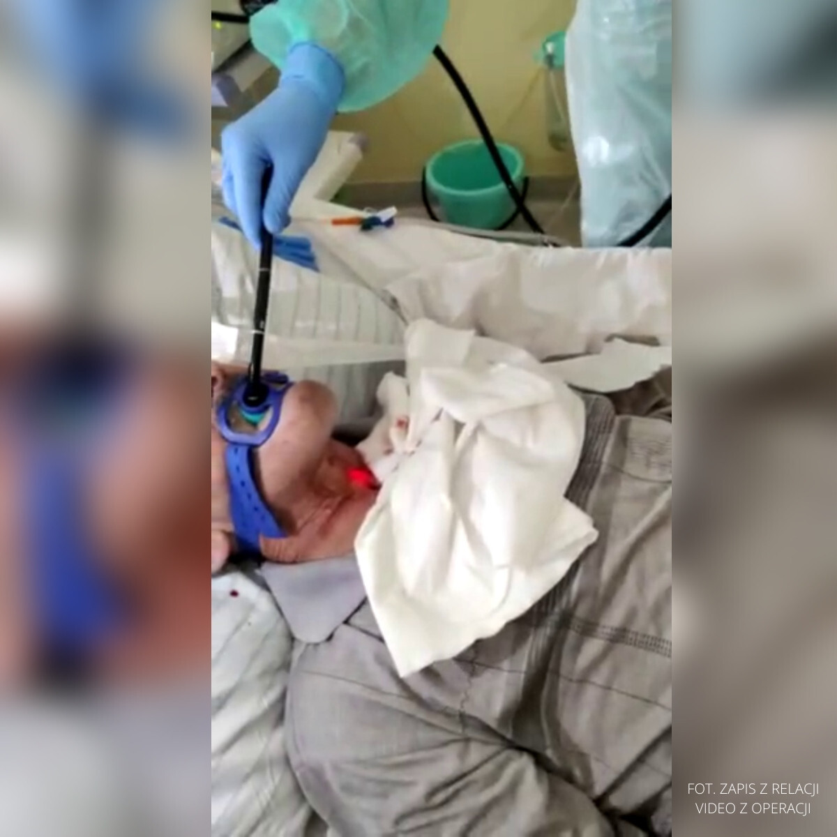 Szpital Slaski proteza glosowa 1