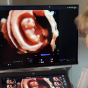 Usg prenatalne katowice