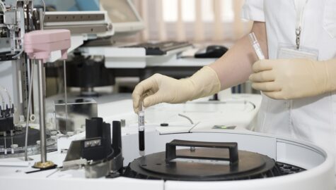 Bezplatne badania sosnowiec