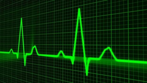 Pulse trace gbf33461a3 1280