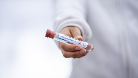 Test tube 5065426 1920 2