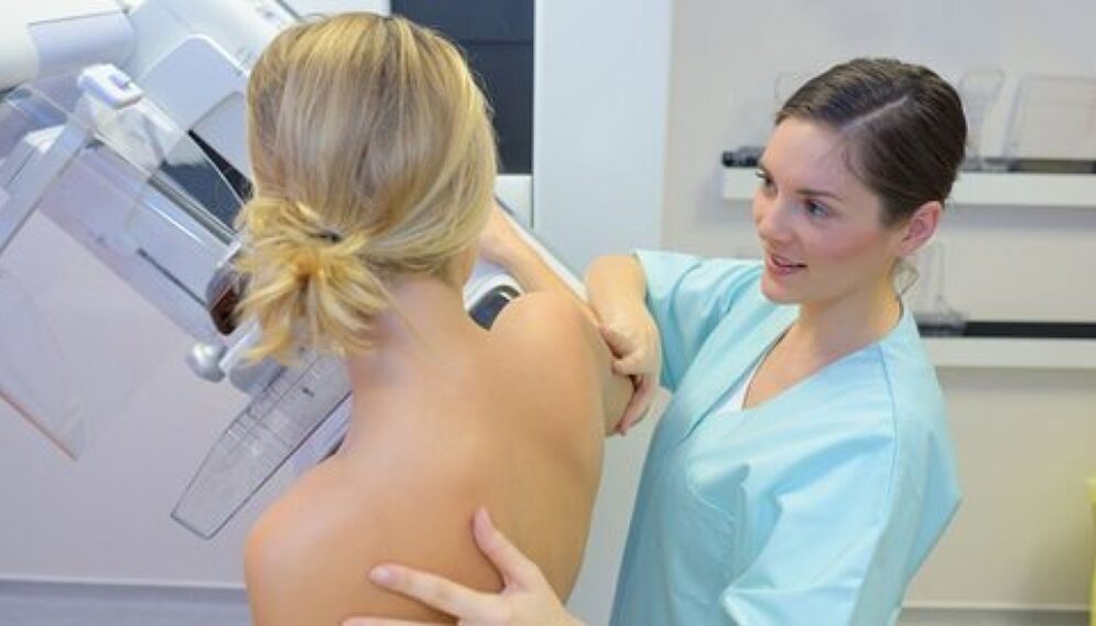 Csm mammografia 7 c0c6beb82a 02