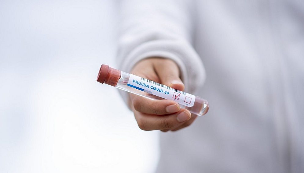 Csm test tube 5065426 1920 2 7da109166a