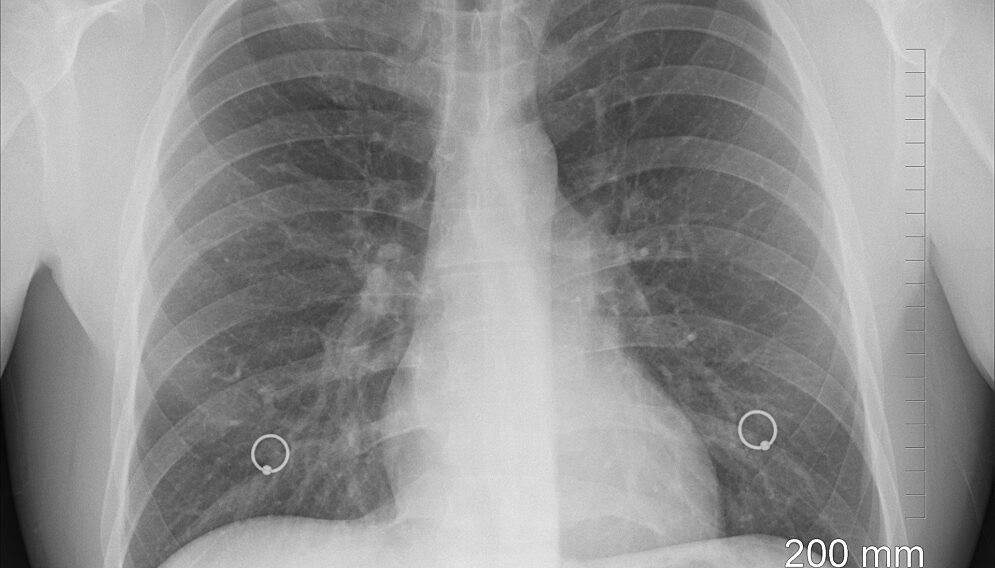 Diagnosis 1476620 1920 01