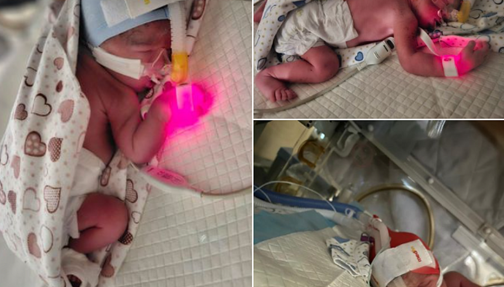 Trojaczki w rudzie slaskiej