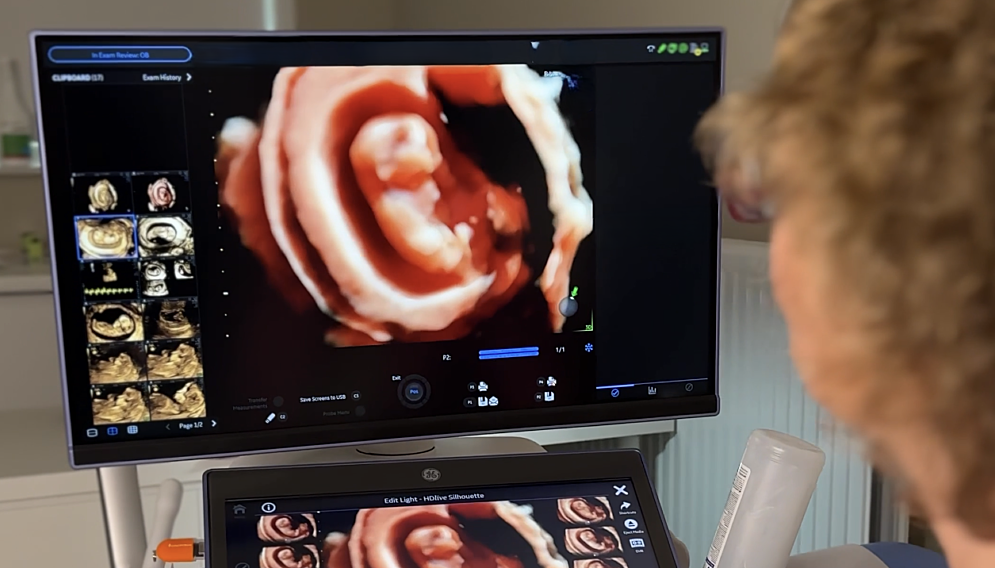 Usg prenatalne katowice