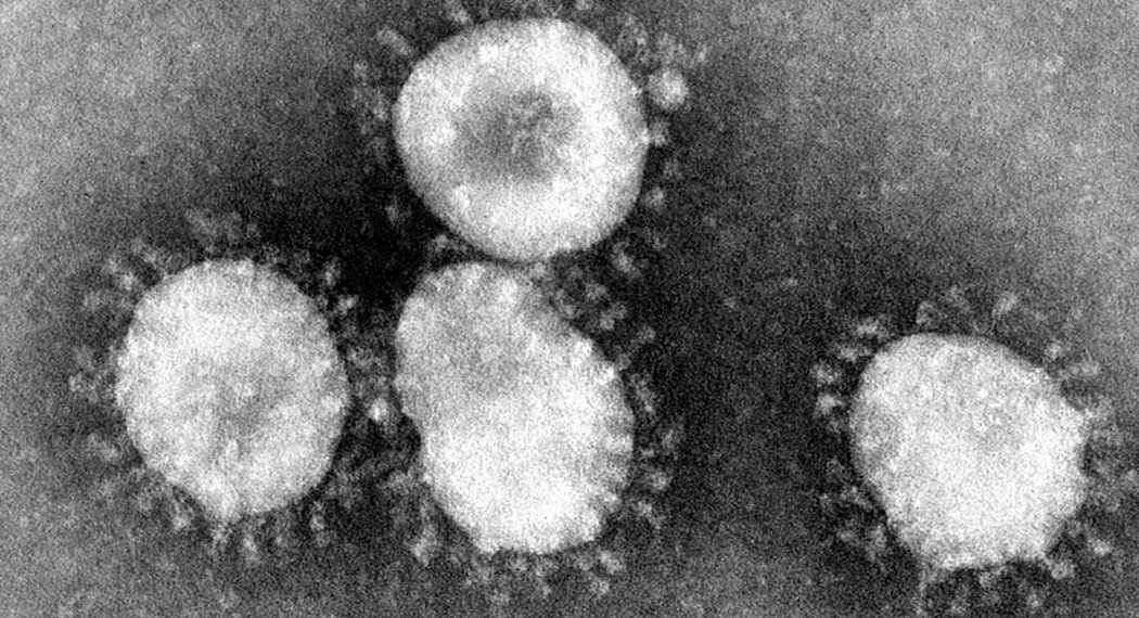 Csm 1280px Coronaviruses 004 lores 9a9855d0d2