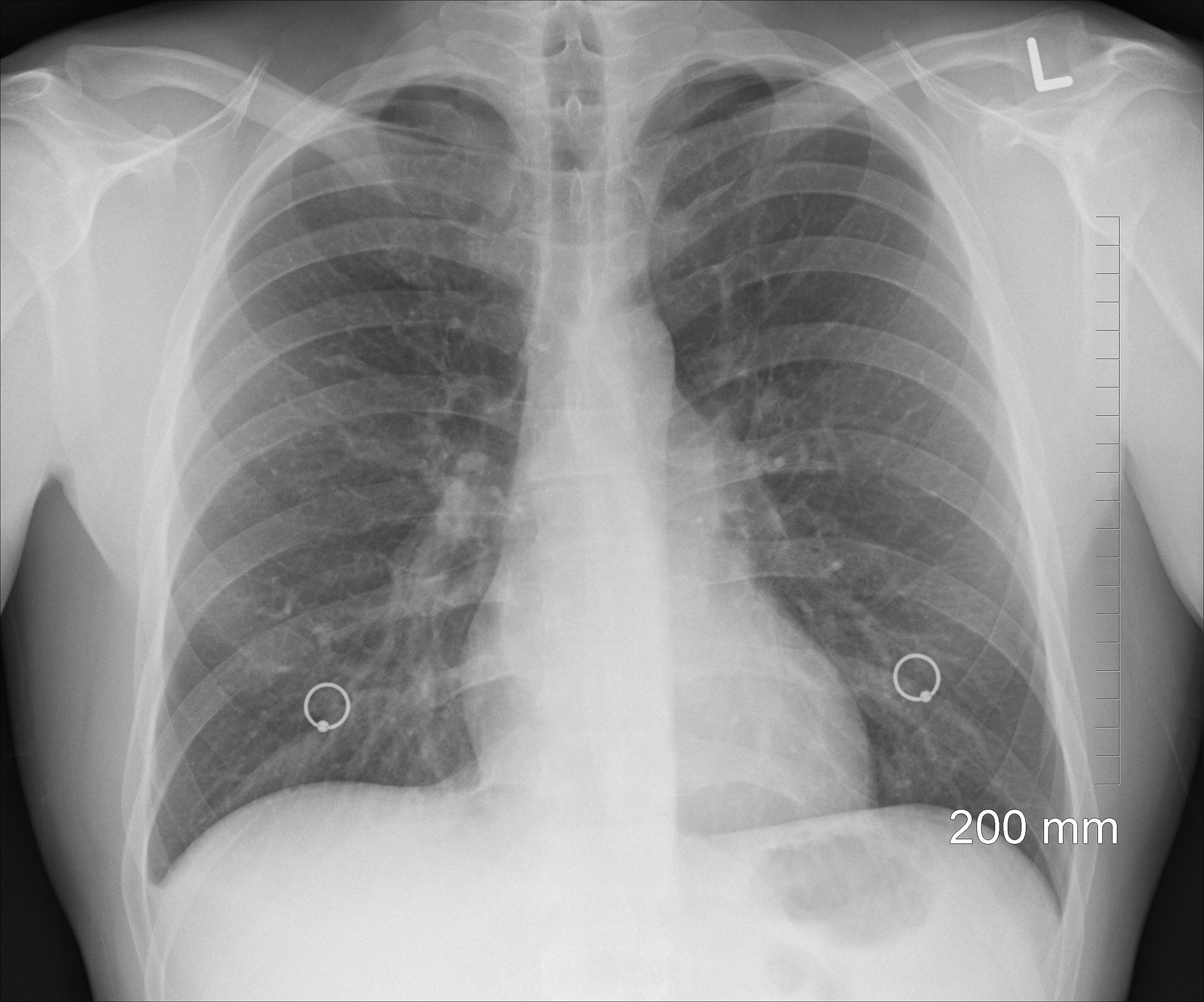 Diagnosis 1476620 1920
