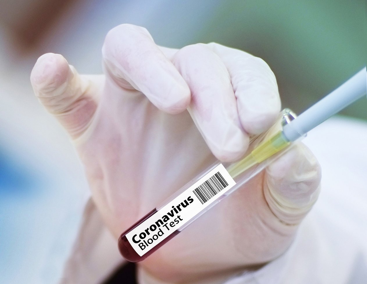 Vaccine 4946480 1920 01